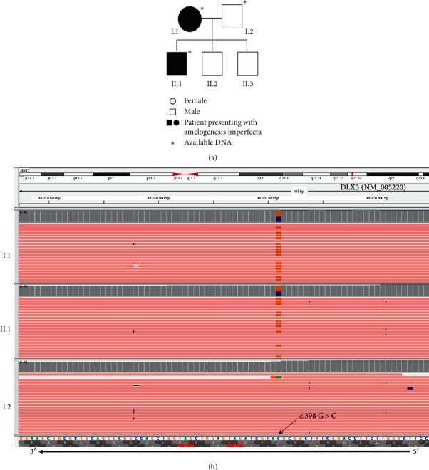 "Isolated" Amelogenesis Imperfecta Associated with <i>DLX3</i> Mutation: A Clinical Case.