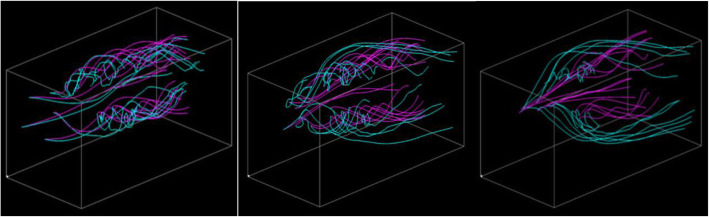 Streamline pair selection for comparative flow field visualization.