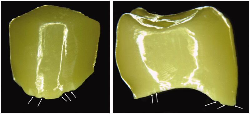 Damage tolerance of six dental zirconias with different translucencies.