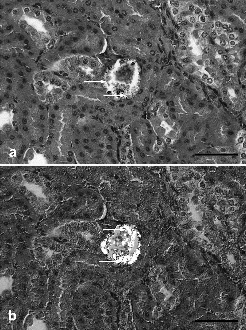 A possible case of renal oxalate deposit reported in an African fruit bat (<i>Epomops franqueti</i>).