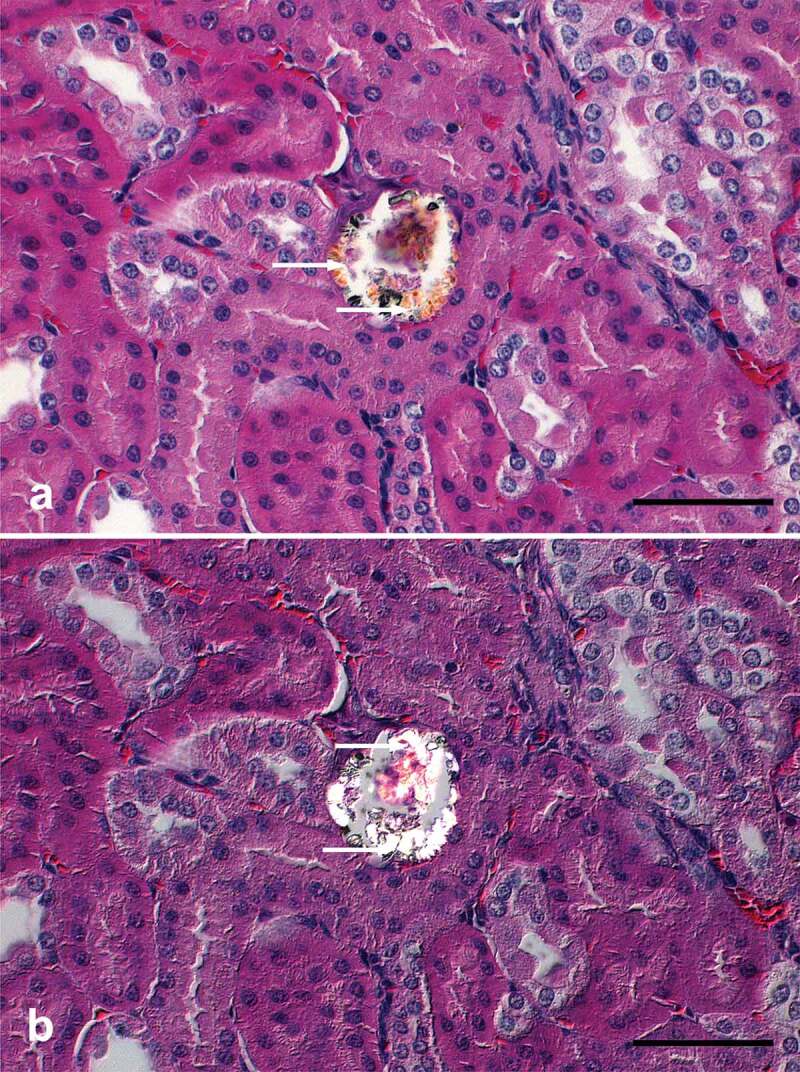 A possible case of renal oxalate deposit reported in an African fruit bat (<i>Epomops franqueti</i>).