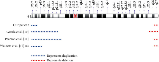 An Adolescent with a Rare <i>De Novo</i> Distal Trisomy 6p and Distal Monosomy 6q Chromosomal Combination.