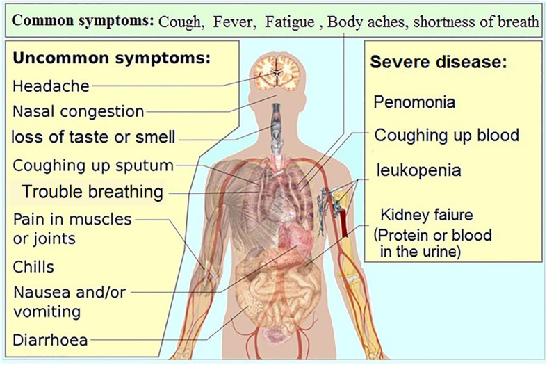 A comprehensive review of COVID-19 characteristics.