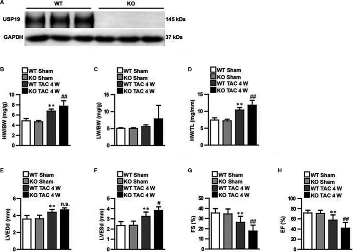 Ubiquitin-specific protease 19 blunts pathological cardiac hypertrophy via inhibition of the TAK1-dependent pathway.