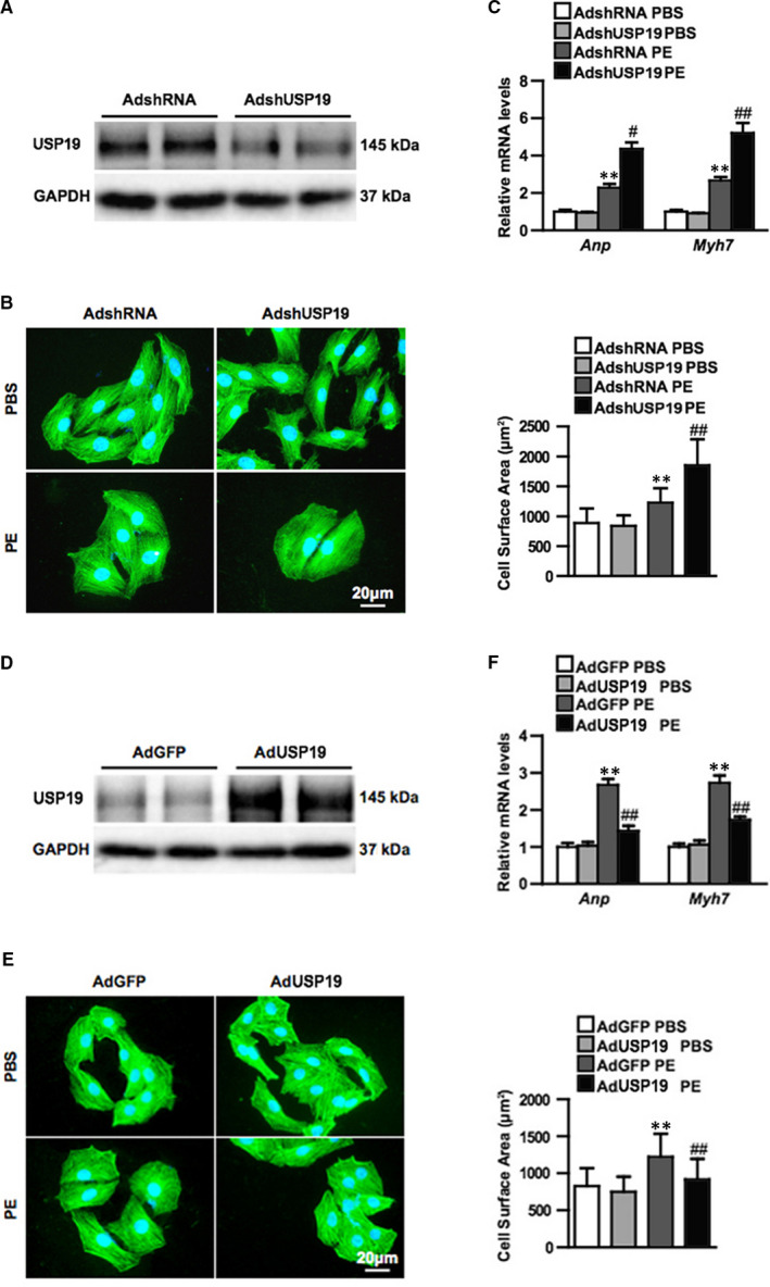 Ubiquitin-specific protease 19 blunts pathological cardiac hypertrophy via inhibition of the TAK1-dependent pathway.