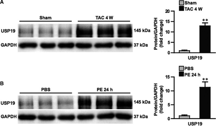 Ubiquitin-specific protease 19 blunts pathological cardiac hypertrophy via inhibition of the TAK1-dependent pathway.