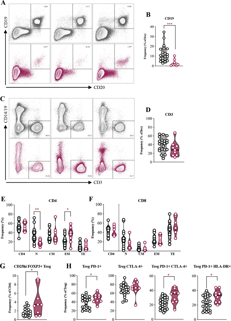 B cell deficiency in patients with relapsed and refractory acute myeloid leukemia.