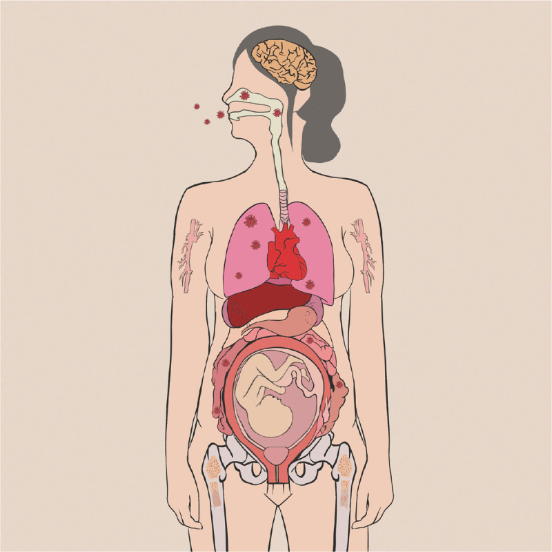 Human Coronavirus Infections and Pregnancy.