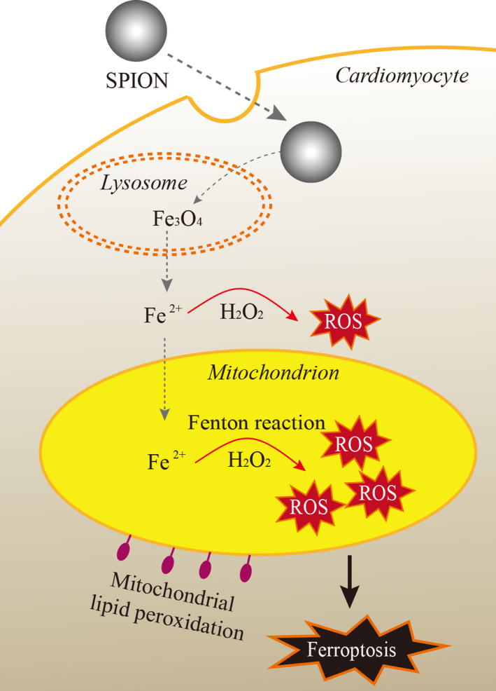 Superparamagnetic iron oxide nanoparticles promote ferroptosis of ischemic cardiomyocytes.