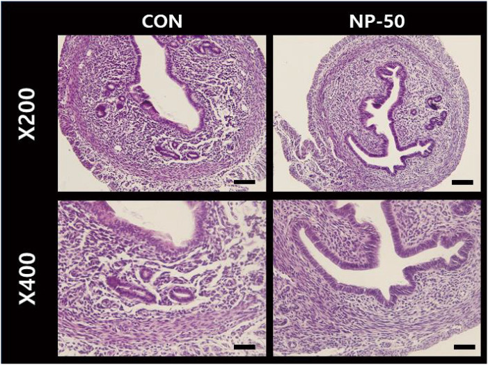 Histological Analysis of Reproductive System in Low-Dose Nonylphenol-treated F1 Female Mice.