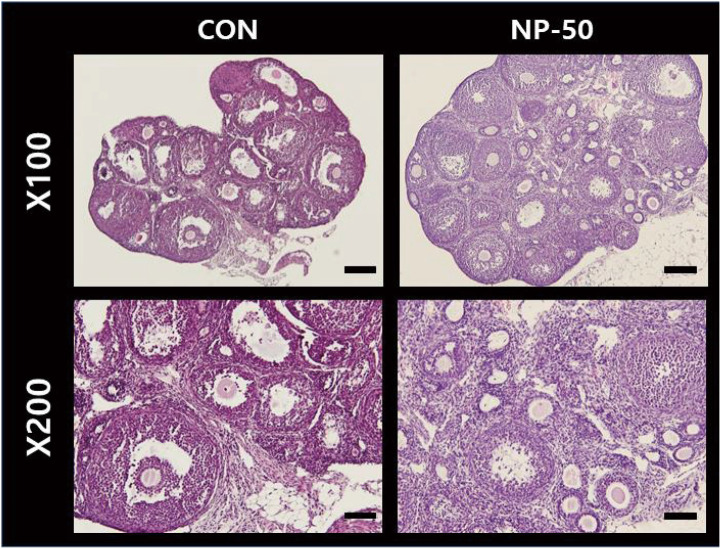 Histological Analysis of Reproductive System in Low-Dose Nonylphenol-treated F1 Female Mice.