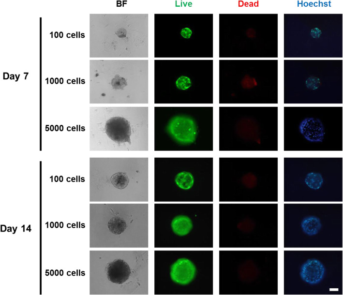 Development of an In Vitro 3D Model for Investigating Ligamentum Flavum Hypertrophy.