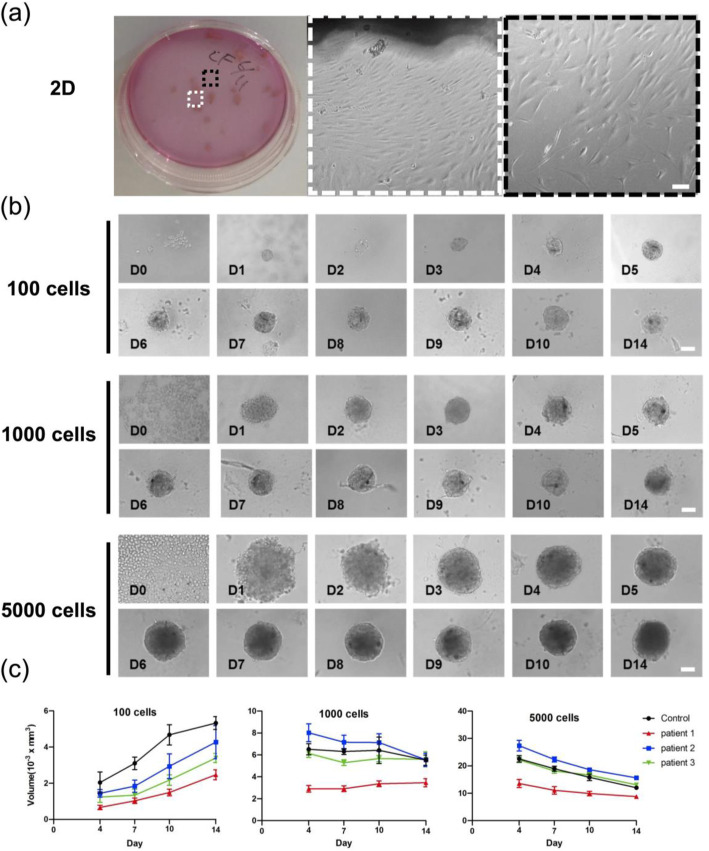 Development of an In Vitro 3D Model for Investigating Ligamentum Flavum Hypertrophy.