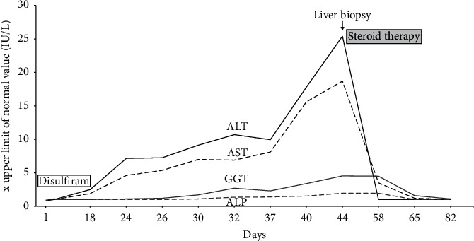 Disulfiram-Induced Acute Liver Injury.
