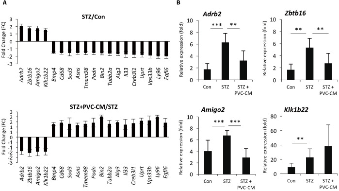 Altered Gene Expression Profiles in the Lungs of Streptozotocin-induced Diabetic Mice.