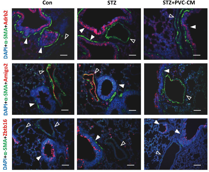 Altered Gene Expression Profiles in the Lungs of Streptozotocin-induced Diabetic Mice.