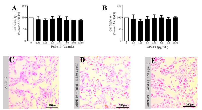 Intravitreal injection of peptides PnPa11 and PnPa13, derivatives of <i>Phoneutria nigriventer</i> spider venom, prevents retinal damage.