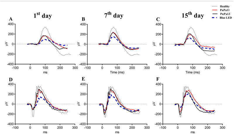 Intravitreal injection of peptides PnPa11 and PnPa13, derivatives of <i>Phoneutria nigriventer</i> spider venom, prevents retinal damage.