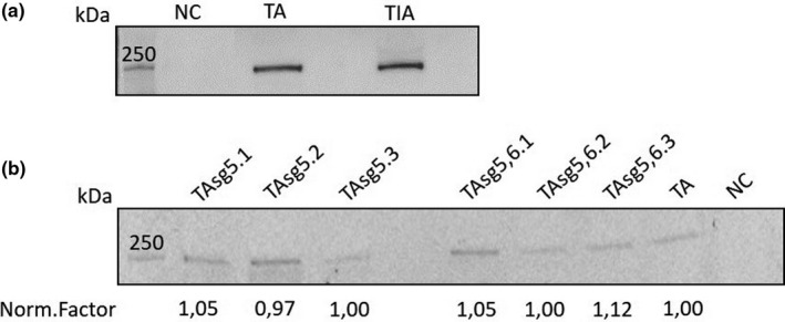 Hypomethylation of the promoter region drives ectopic expression of TMEM244 in Sézary cells.