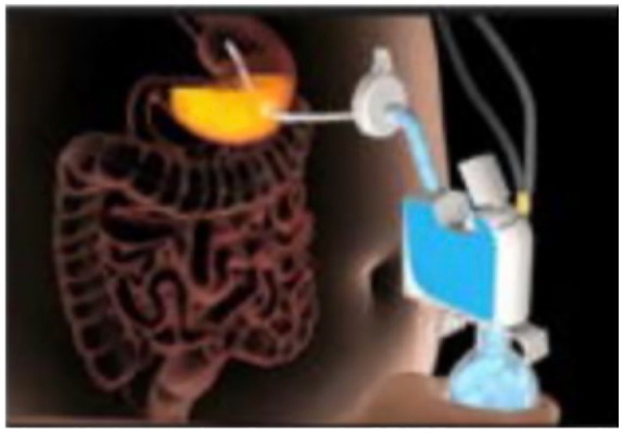 Overview of bariatric and metabolic endoscopy interventions.