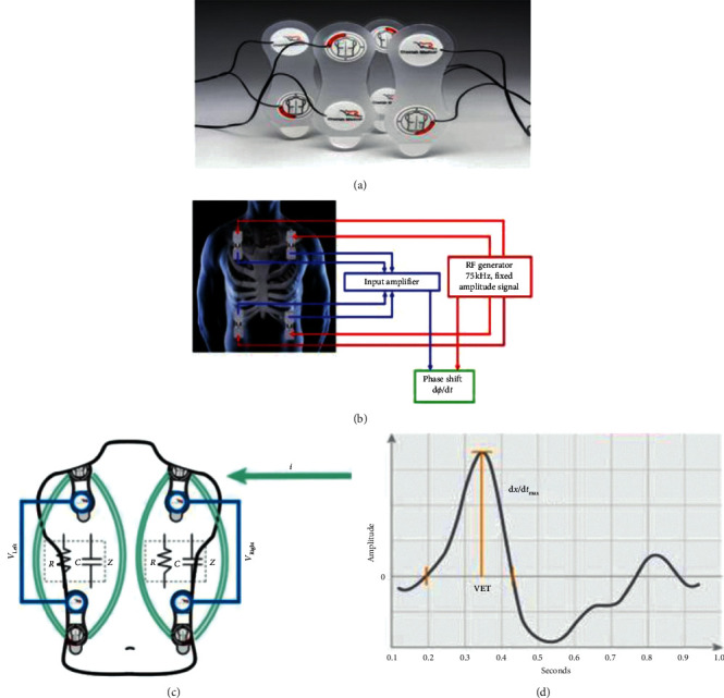 Bioreactance-Based Noninvasive Fluid Responsiveness and Cardiac Output Monitoring: A Pilot Study in Patients with Aneurysmal Subarachnoid Hemorrhage and Literature Review.