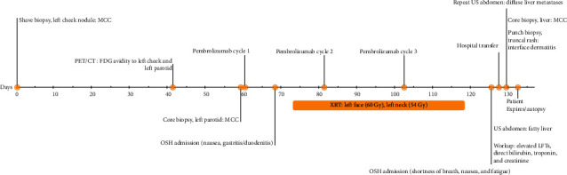 Metastatic Merkel Cell Carcinoma Masquerading as Multiple Immune-Related Adverse Events.