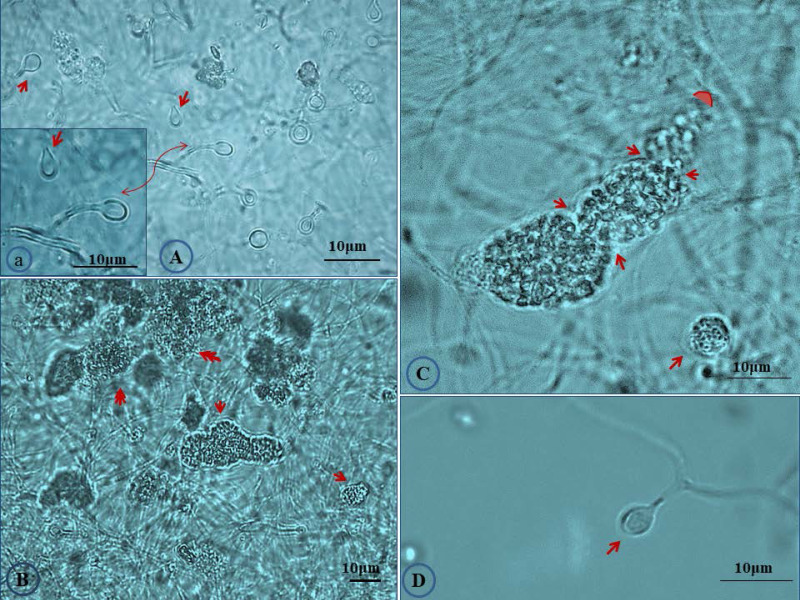 Draft Genome Sequences for the <i>Frankia</i> sp. strains CgS1, CcI156 and CgMI4, Nitrogen-Fixing Bacteria Isolated from <i>Casuarina</i> sp. in Egypt.