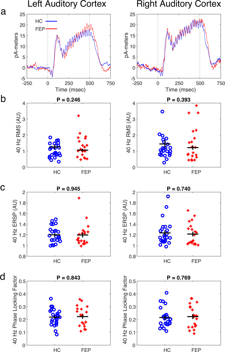 A multimodal magnetoencephalography 7 T fMRI and 7 T proton MR spectroscopy study in first episode psychosis.