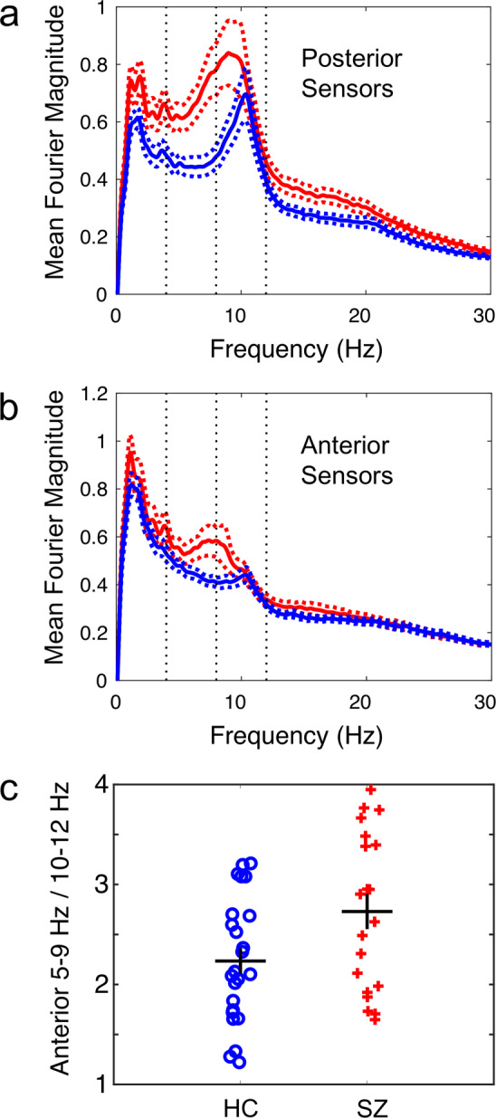 A multimodal magnetoencephalography 7 T fMRI and 7 T proton MR spectroscopy study in first episode psychosis.