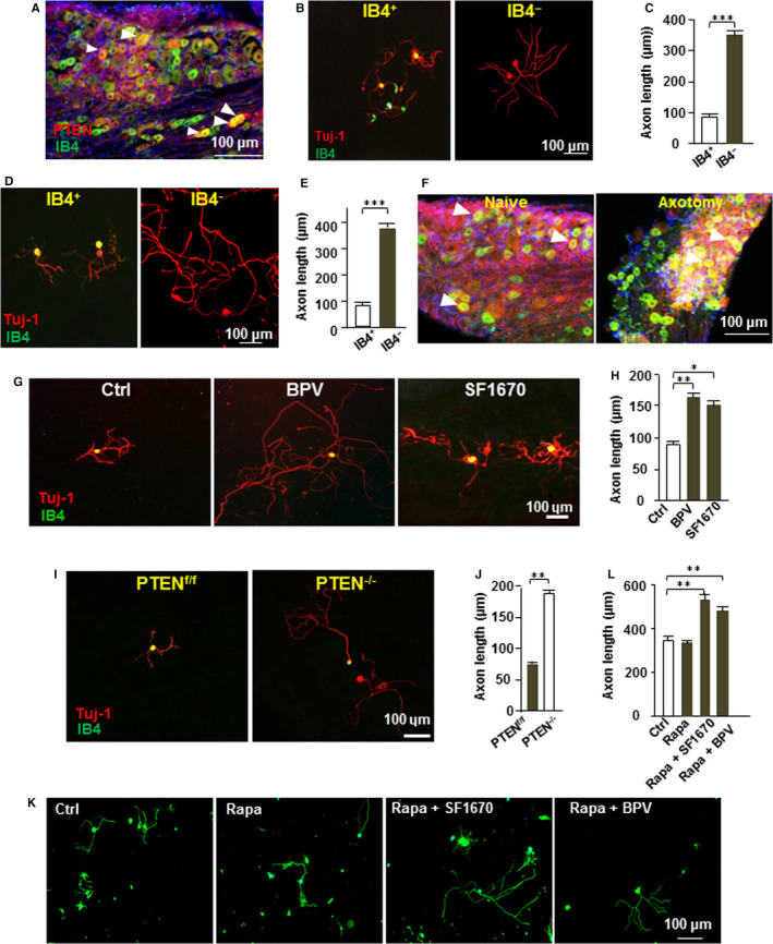 Inhibition of PTEN activity promotes IB4-positive sensory neuronal axon growth.