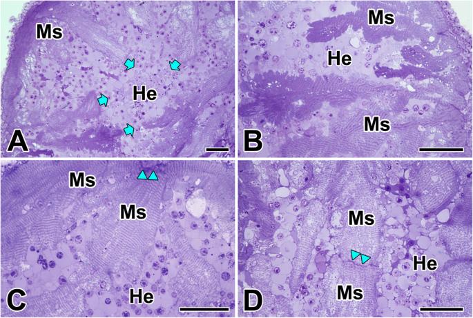 Fine structure of the intercalated disc and cardiac junctions in the black widow spider Latrodectus mactans