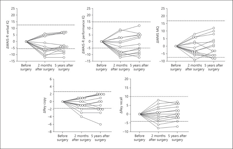 Long-Term Cognitive Changes after Revascularization Surgery in Adult Patients with Ischemic Moyamoya Disease.