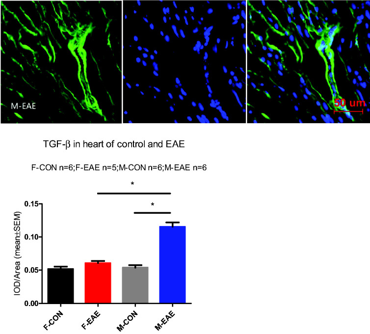 Sex Effect on Cardiac Damage in Mice With Experimental Autoimmune Encephalomyelitis.