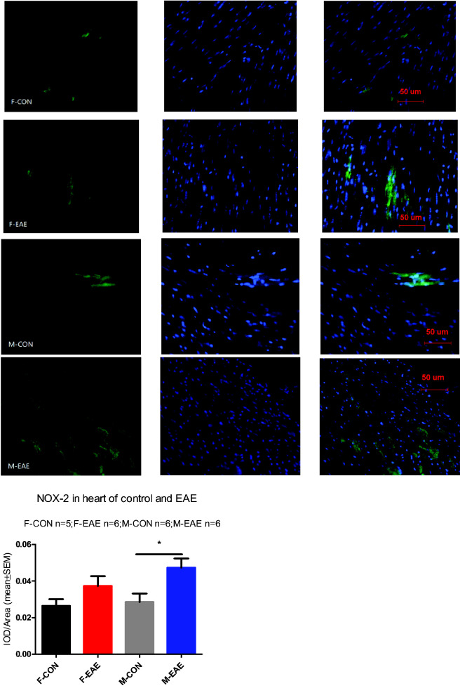 Sex Effect on Cardiac Damage in Mice With Experimental Autoimmune Encephalomyelitis.