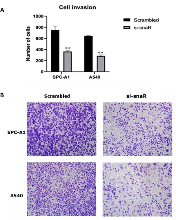 Long Non-coding RNA snaR Promotes Proliferation in EGFR Wild Type Non-Small Cell Lung Cancer Cells.