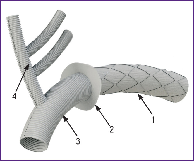 <i>Ab ovo</i>: Factors Affecting the Radial Stiffness of Thoracic Aorta Stent-Grafts.