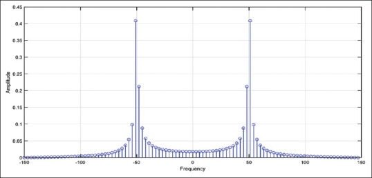 Real-Time Fast Fourier Transform-Based Notch Filter for Single-Frequency Noise Cancellation: Application to Electrocardiogram Signal Denoising.