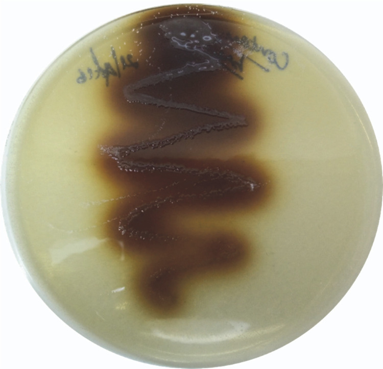 Melanin production by <i>Pseudomonas</i> sp. and <i>in silico</i> comparative analysis of tyrosinase gene sequences.