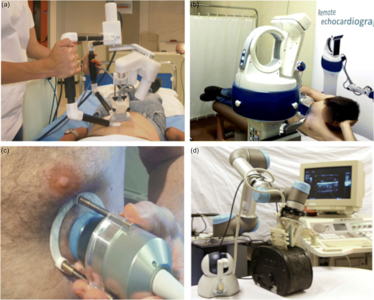 Medical Robotics for Ultrasound Imaging: Current Systems and Future Trends.