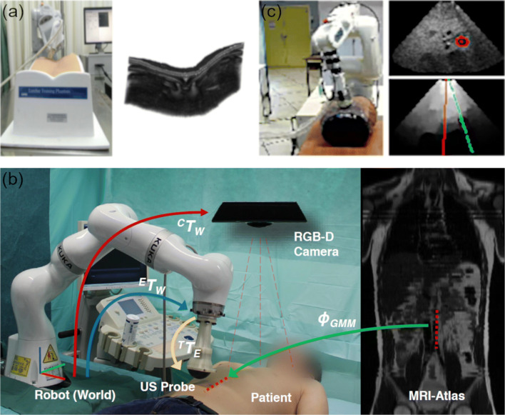 Medical Robotics for Ultrasound Imaging: Current Systems and Future Trends.