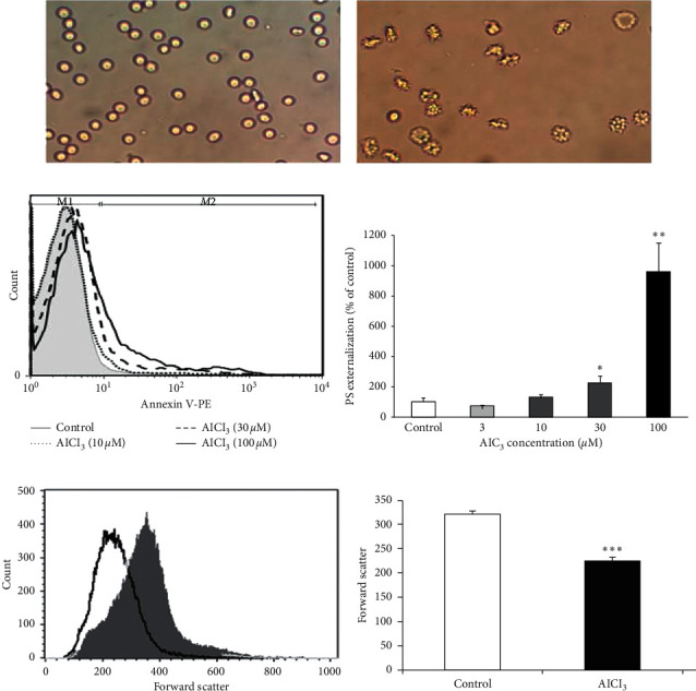 Diverse Effect of Vitamin C and N-Acetylcysteine on Aluminum-Induced Eryptosis.