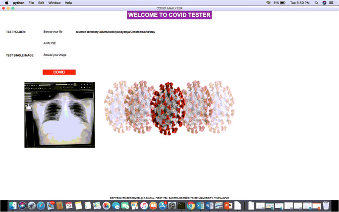 COVID_SCREENET: COVID-19 Screening in Chest Radiography Images Using Deep Transfer Stacking.