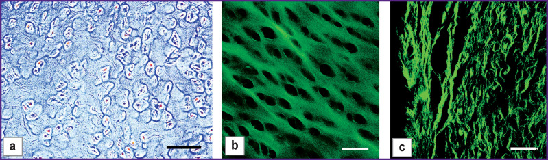 Development of a Two-Layer Porous Scaffold Based on Porcine Nasal Septal Cartilage for Orthopedics.