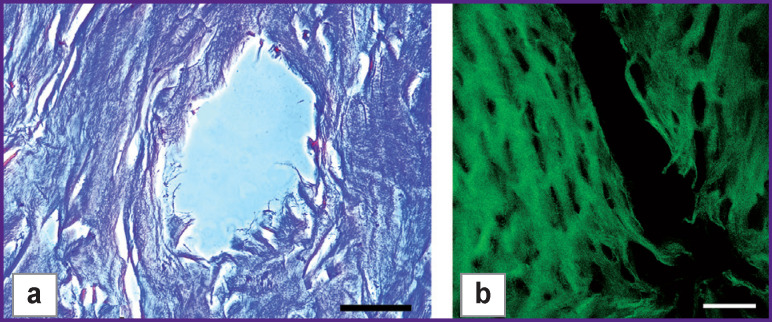 Development of a Two-Layer Porous Scaffold Based on Porcine Nasal Septal Cartilage for Orthopedics.