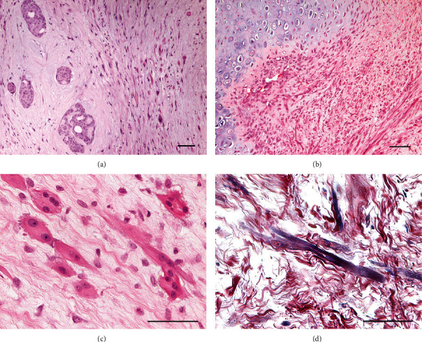 Unusual Myoid Differentiation in a Canine Benign Mixed Mammary Tumour.