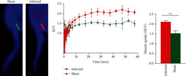 PET Study of Sphingosine-1-phosphate Receptor 1 Expression in Response to <i>S. aureus</i> Infection.