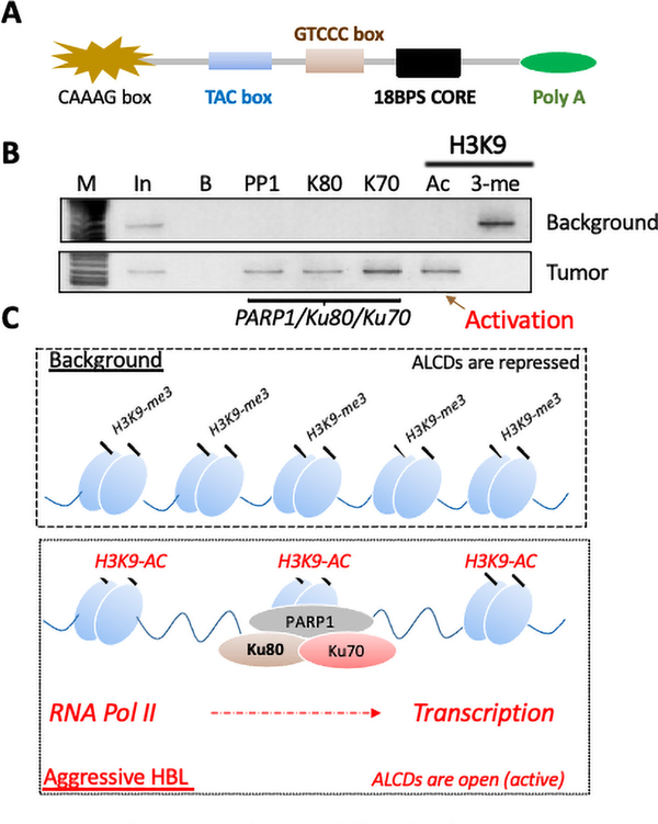 Molecular signatures of aggressive pediatric liver cancer.