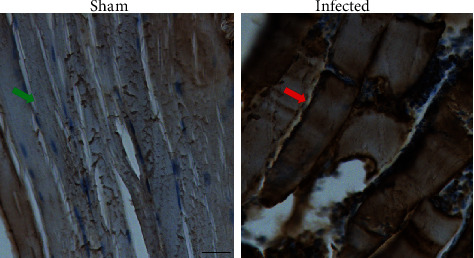 PET Study of Sphingosine-1-phosphate Receptor 1 Expression in Response to <i>S. aureus</i> Infection.