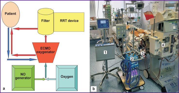 Nitrogen Oxide-Added Extracorporeal Membrane Oxygenation for Treating Critical Acute Heart Failure after Cardiac Surgery.