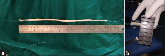 Peroneus Longus Tendon Autograft for Anterior Cruciate Ligament Reconstruction: A Safe and Effective Alternative in Nonathletic Patients.